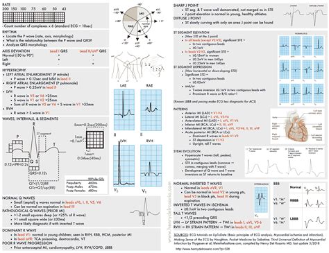 Ecg Cheat Sheet