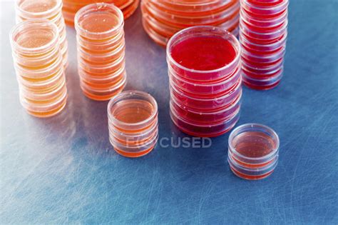 Stacked agar plates with microbiological cultures on plain background. — medical, stacks - Stock ...