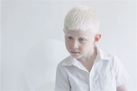 15+ Albino People Who’ll Mesmerize You With Their Otherworldly Beauty - An Eclectic Site for ...