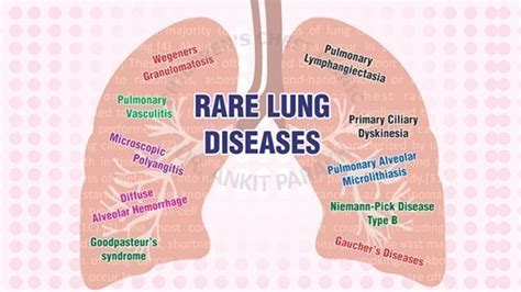 Rare Lung Diseases - Dr. Ankit Parakh