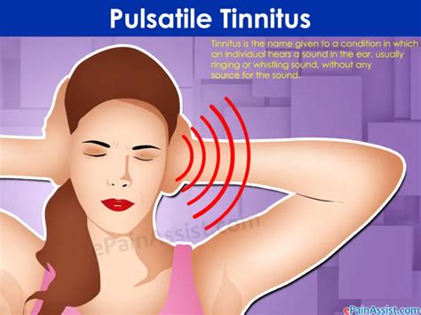 pulsatile-tinnitus - Pulsatile Tinnitus