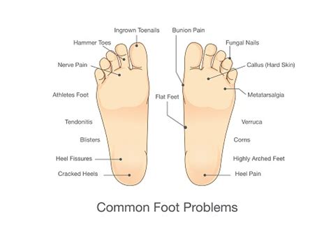 Types Of Foot Pain Causes