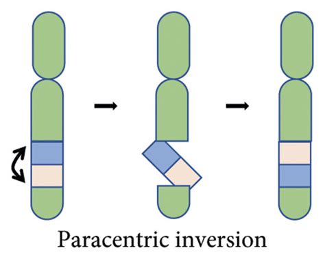 Chromosomal inversions: two breaks in the same chromosome, causing the ...