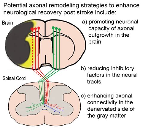 A diagram showing corticospinal tract (CST) axonal degeneration and... | Download Scientific Diagram