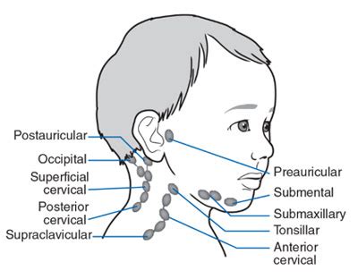 Painful lymph nodes - ascsefactor