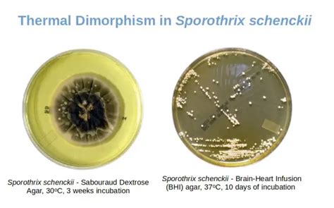 Dimorphic Fungi: Disease, Properties • Microbe Online