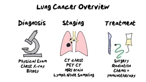 PRIMR | New Lung Cancer Diagnosis - What to Expect