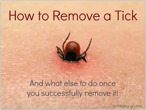 How to Remove A Tick: And What to Do Once You've Been Bitten