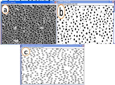 The minute branches of dentinal tubules or any other Particles smaller... | Download Scientific ...