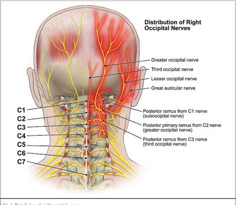 Headache and neck pain: is it possible that nerve compression is to ...