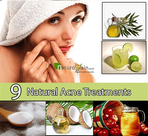 Natural Acne Treatment - Treat Acne with These 9 Natural Cures