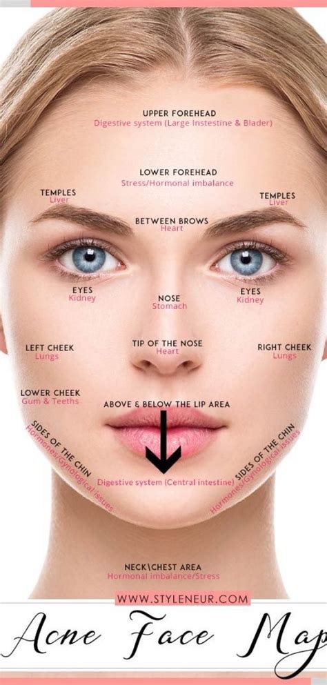 acne chart reasons ~ #acne #chart #reasons | Forehead acne, Face ...