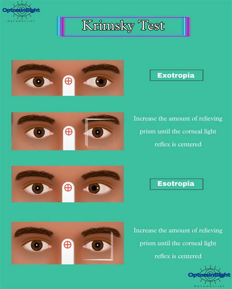 Corneal Reflex