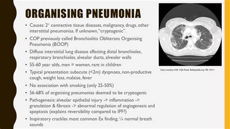 Organizing Pneumonia