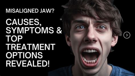 Misaligned Jaw? Causes, Symptoms & Top Treatment Options Revealed! - Herring Chiropractic Clinic