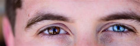 What Is the Rarest Eye Color? You Might Be Surprised