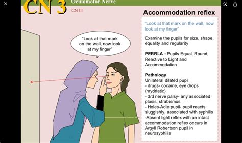 Accommodation (reflex) | Eyes, Homeopathy, Memes