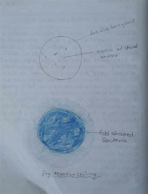 Study of Negative Staining: Procedure & Results - All Bachelor