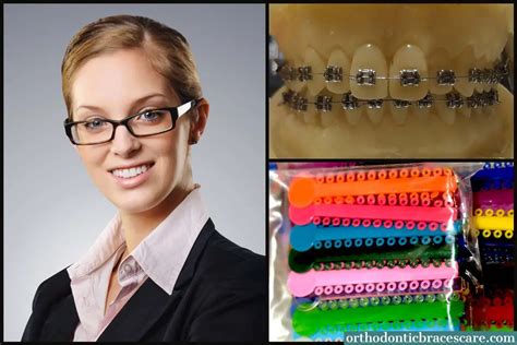 Best Braces Colors For Adults: How To Choose - Orthodontic Braces Care