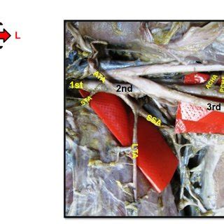 Illustration showing superior thoracic artery, 2 lateral thoracic... | Download Scientific Diagram