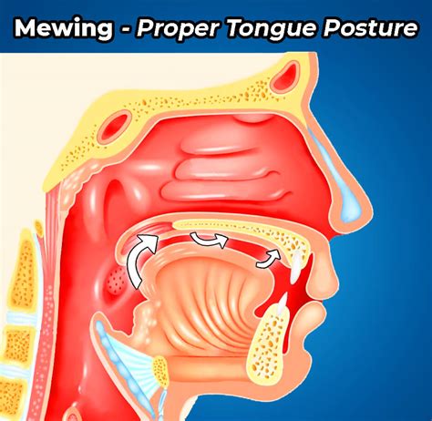 How To Tell If You Are Mewing Correctly | ENT Doctor’s Opinion