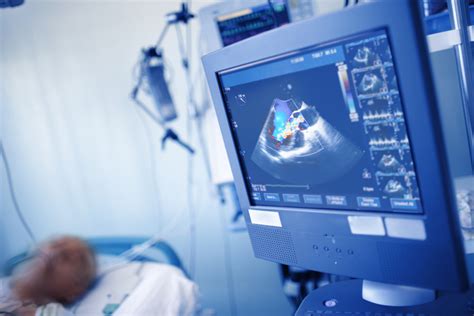 Heart Ultrasound Scans - What to Expect - Heart Health