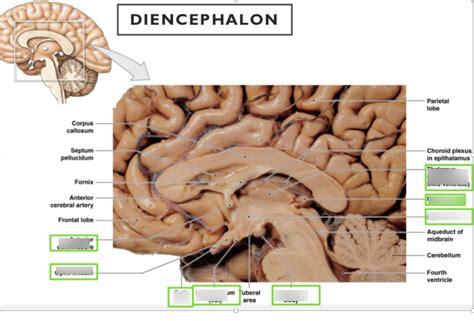 3f_ Diencephalon - epithalamus, thalamus, hypothalamus, and subthalamus Diagram | Quizlet