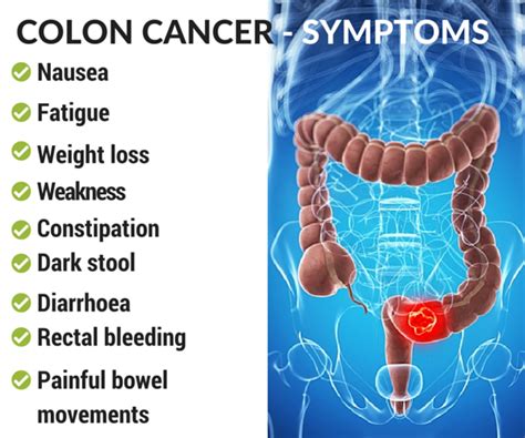 annies home: Risk and Symptoms of Colon Cancer