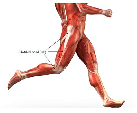 4 Common Causes of IT Band Syndrome | FUNCTIONAL MEDICINE, SIBO, IBS & LEAKY GUT- DR HOUSTON ...