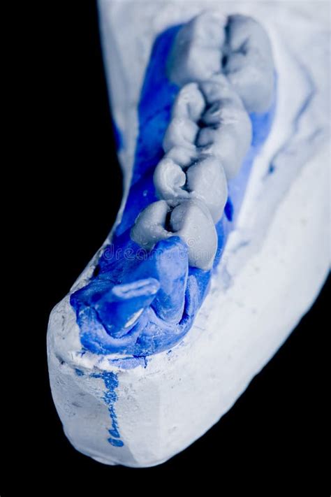 Human teeth, model stock photo. Image of anatomical, bite - 5146852