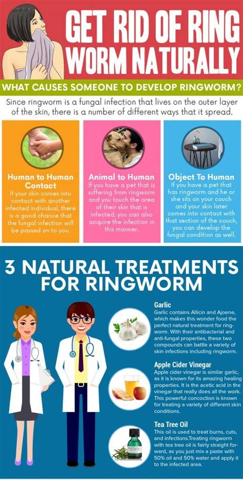 Natural Ringworm Remedies to Keep in Your Home - NaturalRelieved