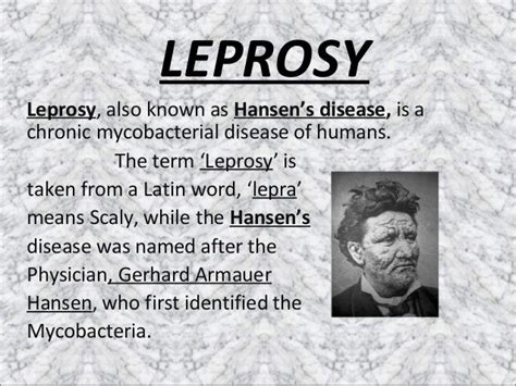 Leprosy