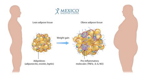 Does Bariatric Surgery Improve Adipose Tissue Function? - Fat Tissue