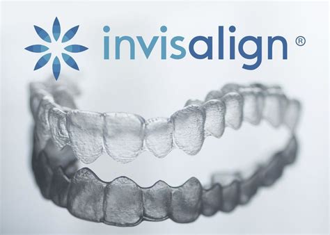 Invisalign Attachments/Buttons - Woodinville, WA - Signature Smiles