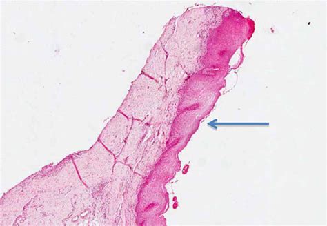 Histologic section of the area correspondent to the mucogingival... | Download Scientific Diagram