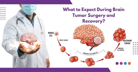 What to Expect During Brain Tumor Surgery and Recovery?