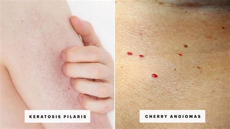 Skin Rash: 7 Causes of Red Spots and Bumps, With Pictures | Allure