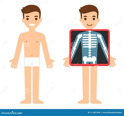 X Ray Cartoon Characters