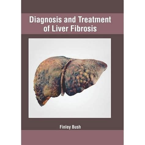 Diagnosis and Treatment of Liver Fibrosis (Hardcover) - Walmart.com - Walmart.com