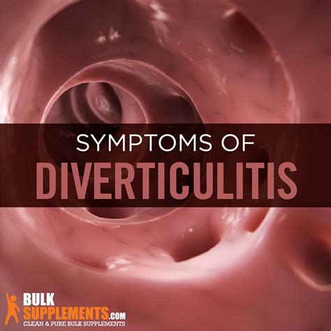 Diverticulitis: Symptoms, Causes & Treatment