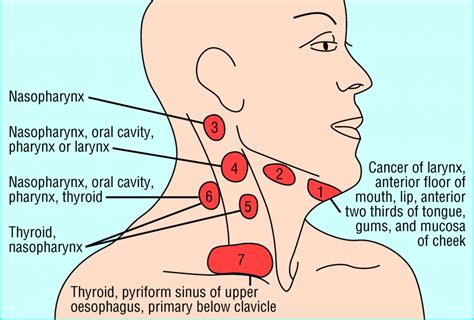 Neck Cat Lymph Nodes Diagram