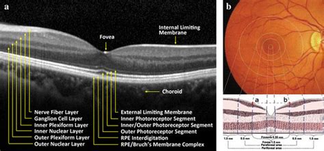 Diagram of normal retinal structure. a Normal retinal tissue layers... | Download Scientific Diagram