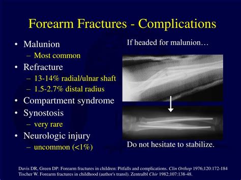 PPT - Pediatric Fractures of the Forearm, Wrist and Hand PowerPoint ...