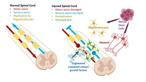 Spinal Cord Injury Program - Neural Stem Cell Institute, Rensselaer NY