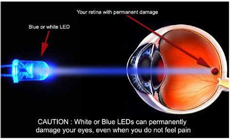 What is Blue Light & Its Effects on Eye Health? - Trinidad and Tobago Eye Care & Optical ...