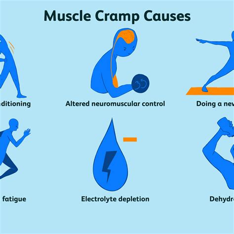 Unbelievable Tips About How To Prevent Night Cramps - Effectsteak33