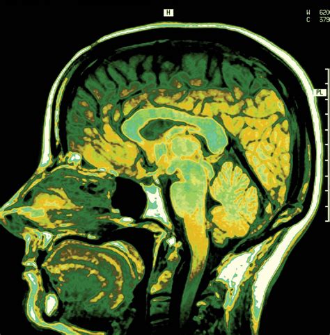 Nuclear magnetic resonance (NMR) | Britannica