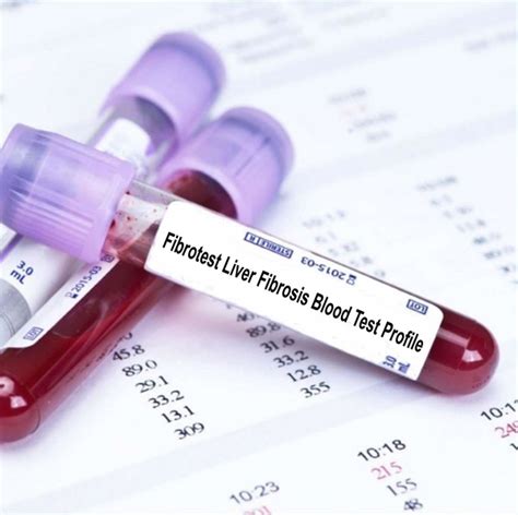 Fibrotest Liver Fibrosis Blood Test Profile | Blood Tests in London