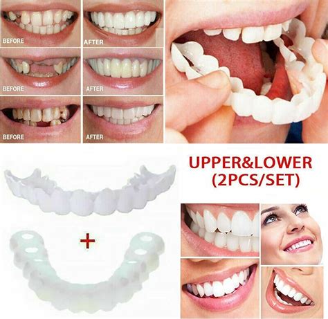 OTCPP 2 Pairs Temporary Teeth Kit - Dental Veneers for Temporary Teeth Restoration | Onecolor