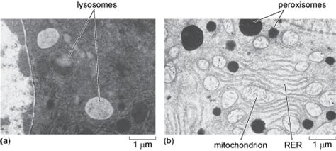 Peroxisome Microscope